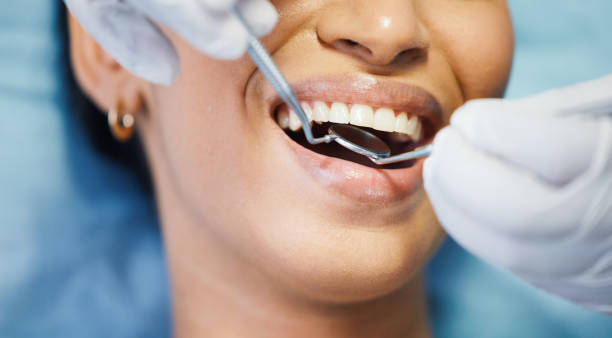 Best Emergency Root Canal Treatment in Phoenix, IL