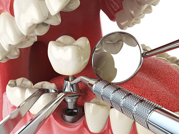 Best Emergency Cosmetic Dentistry in Phoenix, IL