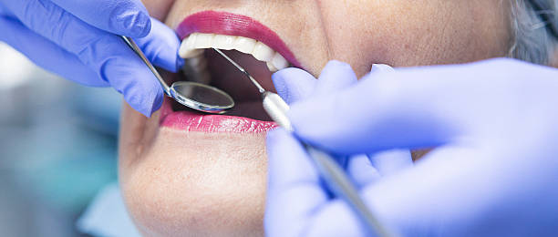 Best Emergency Dentist for Lost Fillings or Crowns in Phoenix, IL